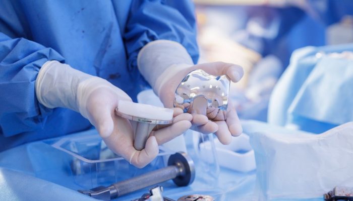 A-jornada-invisivel-de-um-dispositivo-medico.jpg